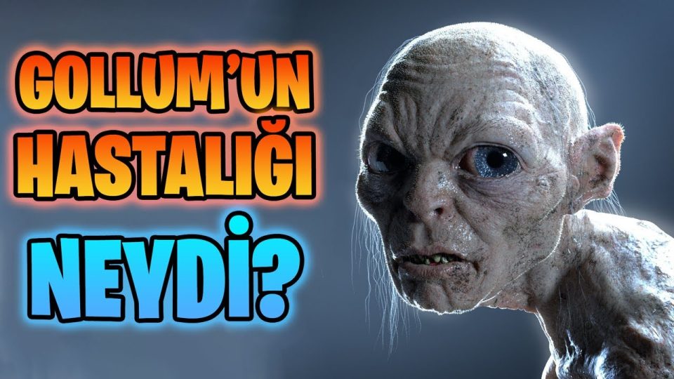 Gollum'un Hastalığı Neydi? - Orta Dünya'dan, KIYMETLİ Bir Vaka Analizi!